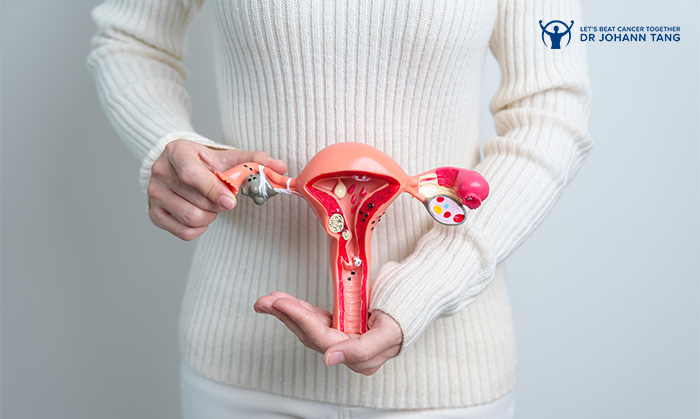 Cervical Cancer vs. Ovarian Cancer: What’s the Difference?