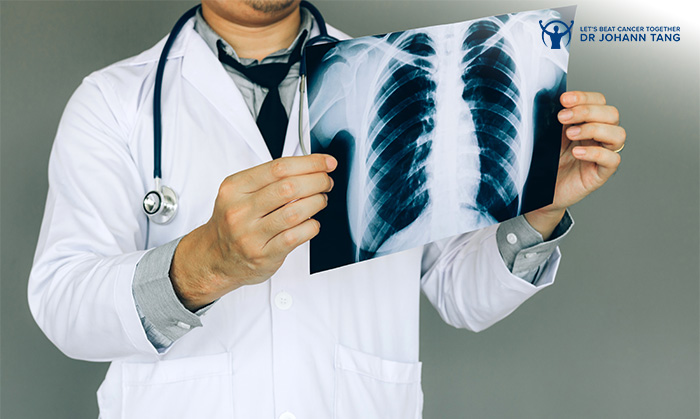 Doctor holding a chest X-ray showing lungs.